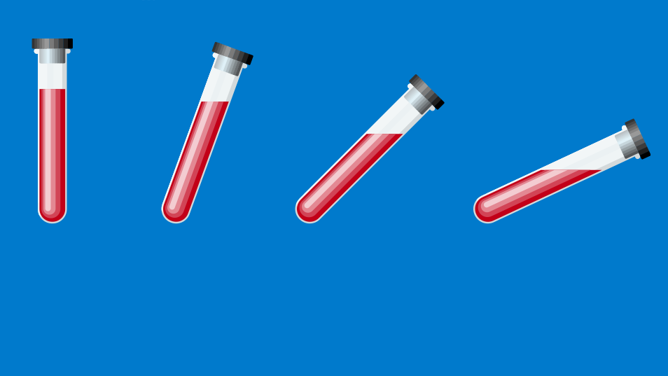 Interpretation of Arterial Blood Gas AB23